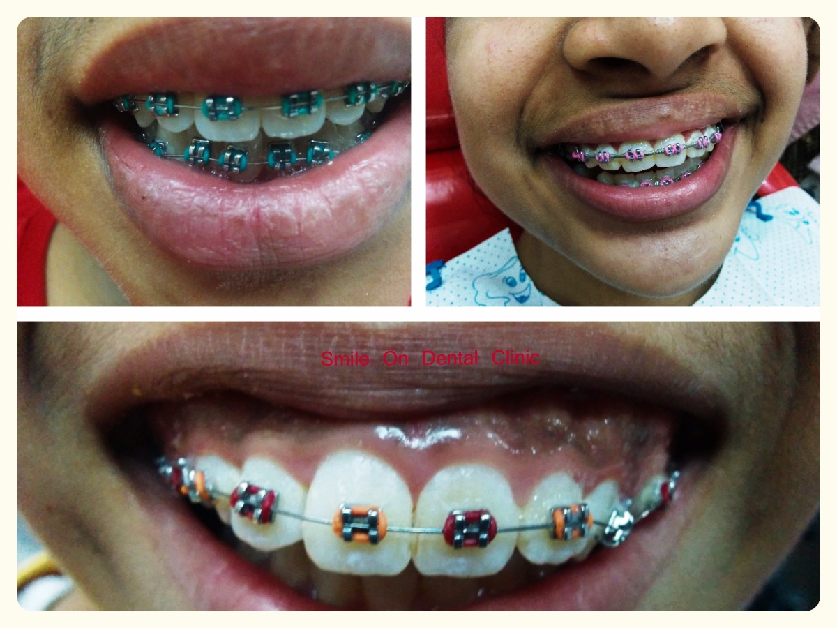 Smile On Dental Clinic Image 2