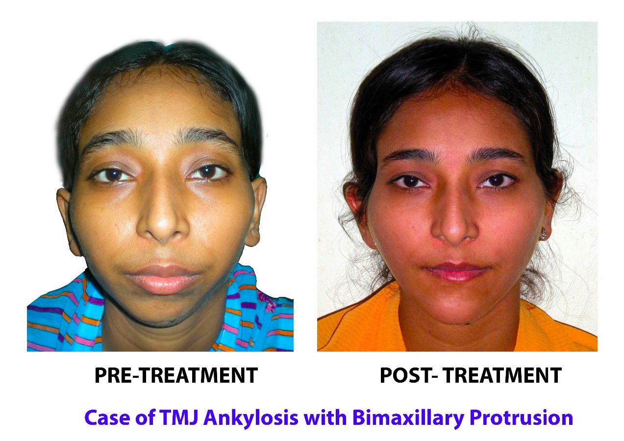 BRACES & IMPLANT CLINIC Image 10
