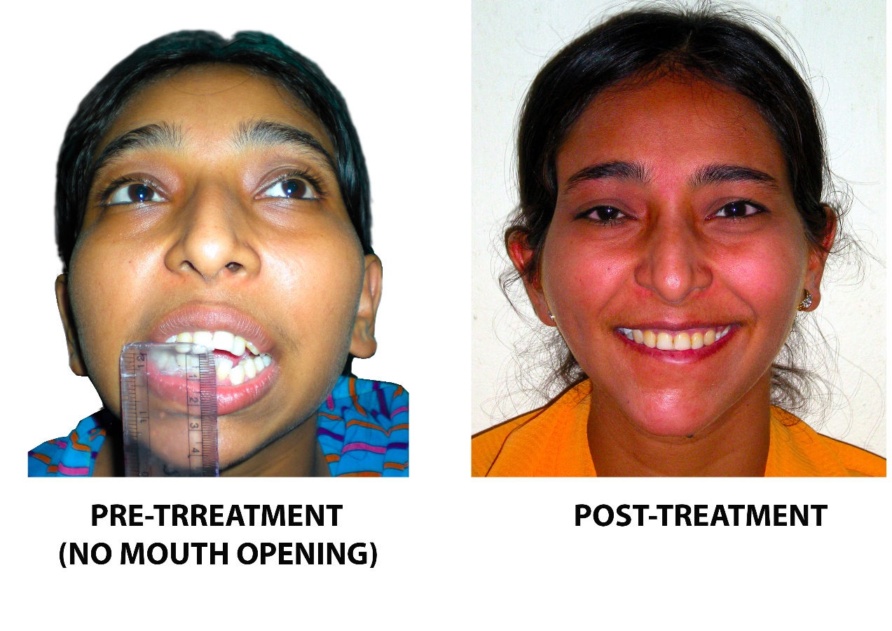 BRACES & IMPLANT CLINIC Image 8