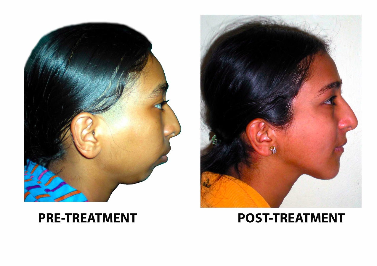 BRACES & IMPLANT CLINIC Image 9