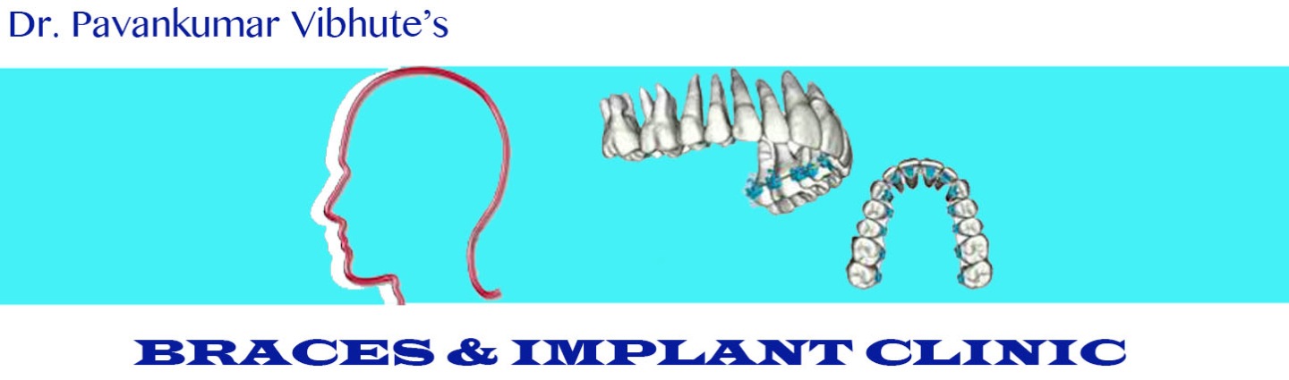 BRACES & IMPLANT CLINIC Image 2