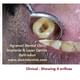 Agrawal Dental Clinic : Implants & Laser Centre Image 6