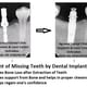 Agrawal Dental Clinic : Implants & Laser Centre Image 10