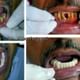 Dr Hiren Prajapati's New Gujarat Dental Clinic Image 7