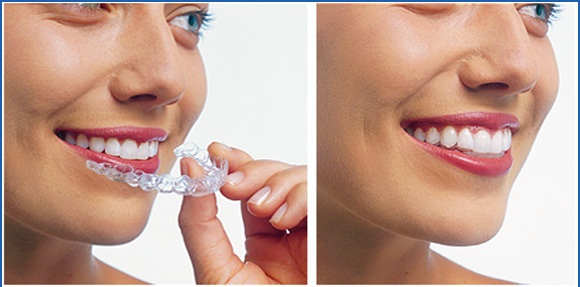 shrinath dental and cosmetic centre Image 5