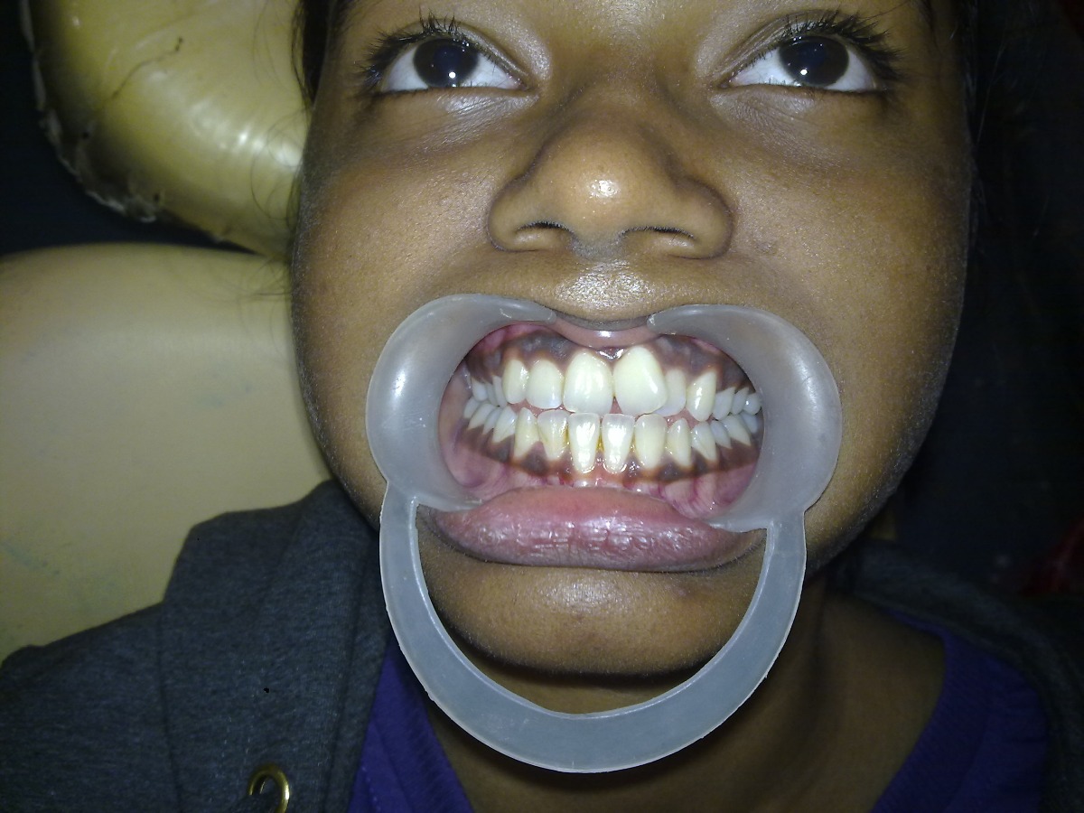 Yogeshwari dental and orthodontic clinic Image 8