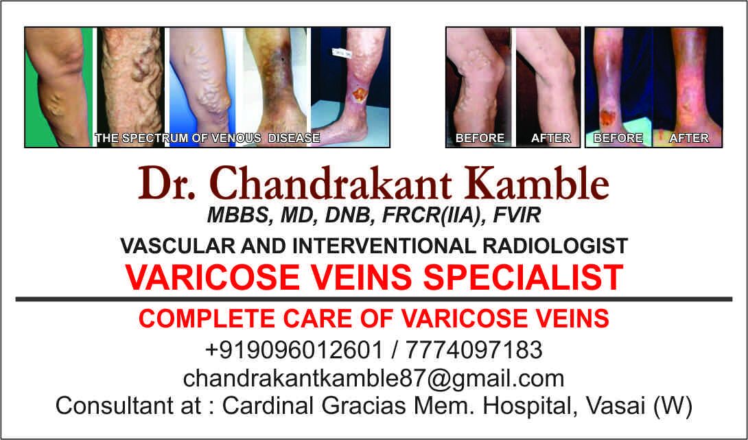 Dr.Chandrakant Varicose Vein Clinic Image 1