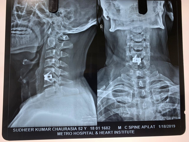 Dr. Dang's Brain & Spine Clinic Image 5