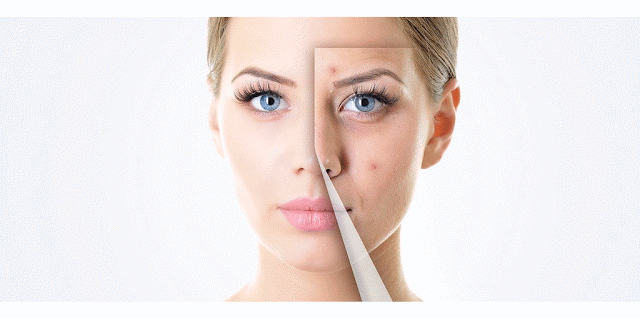 DermaMiracle Skin & Hair Transplant Image 4