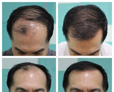 DermaMiracle Skin & Hair Transplant Image 1