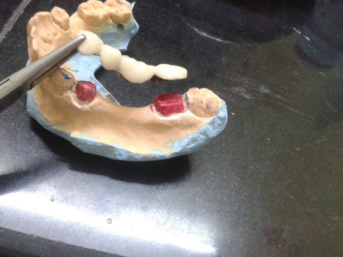 SURYANAGARI DENTAL CLINIC Image 4