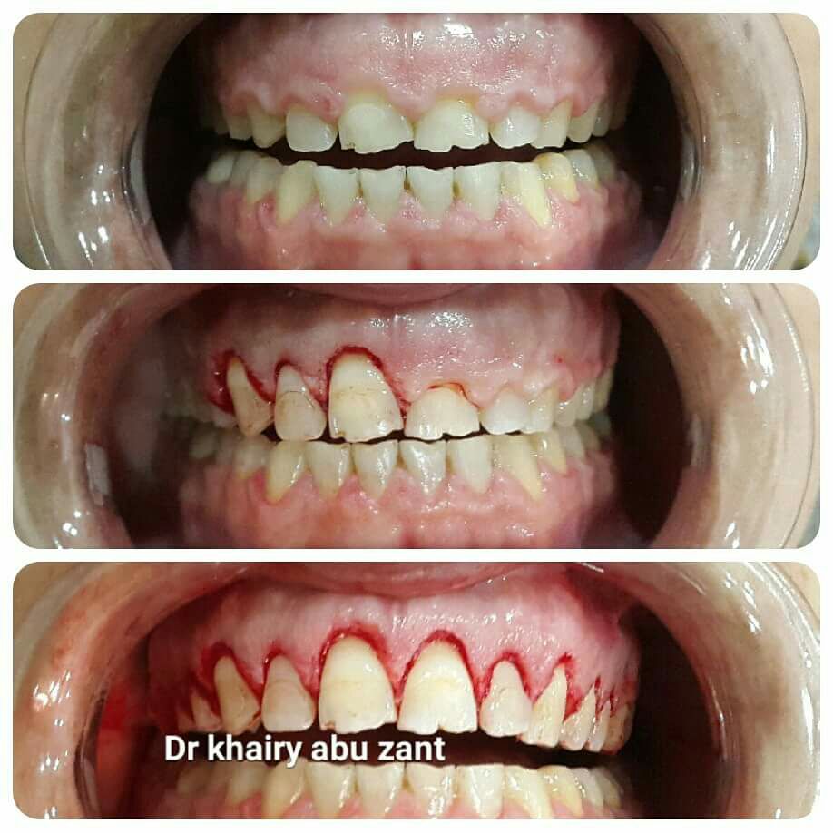 Kallara dental care Image 2