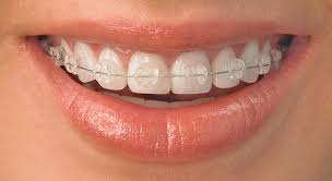 Kallara dental care Image 1