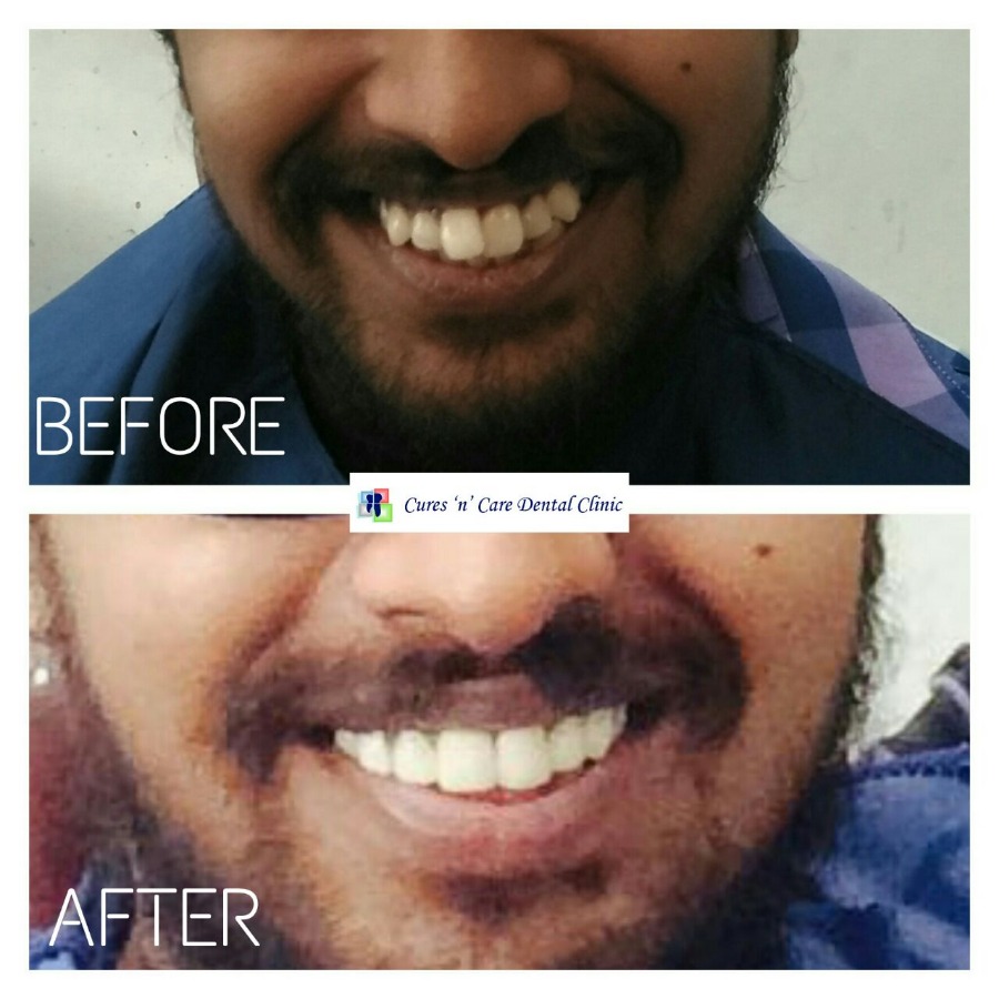 Cures 'n' Care Dental Clinic - Vasundhara Image 4