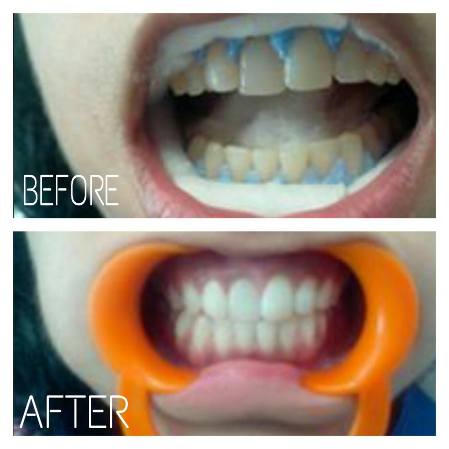 Cures 'n' Care Dental Clinic - Vasundhara Image 5