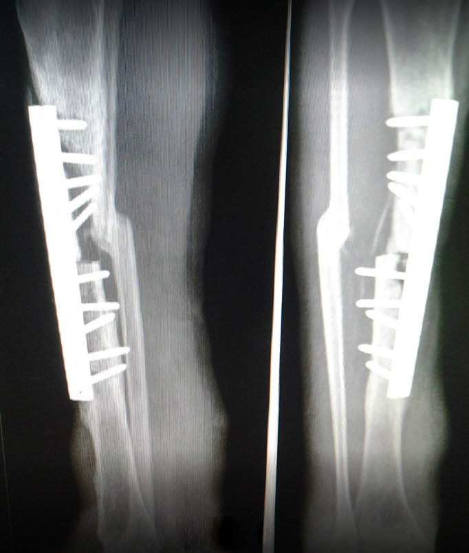 The Neo Orthopedic Clinic Image 5
