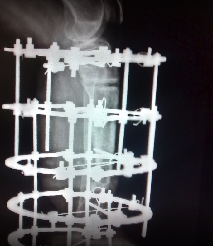 The Neo Orthopedic Clinic Image 4