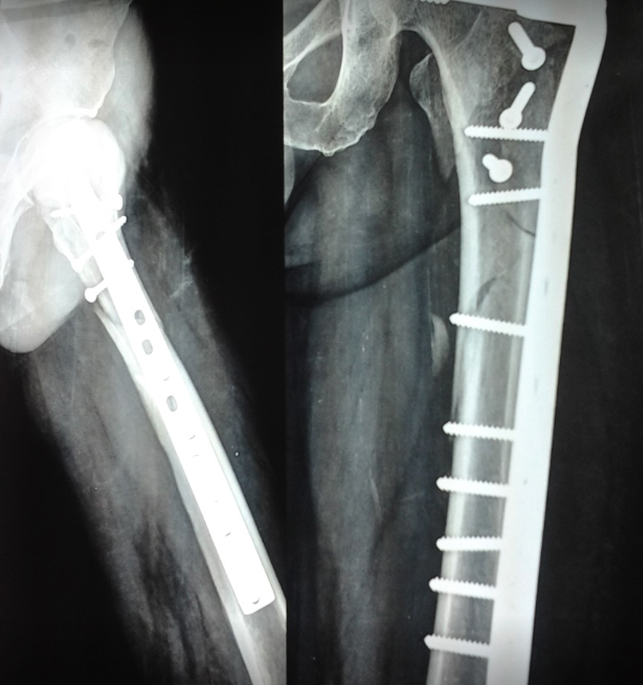 The Neo Orthopedic Clinic Image 2