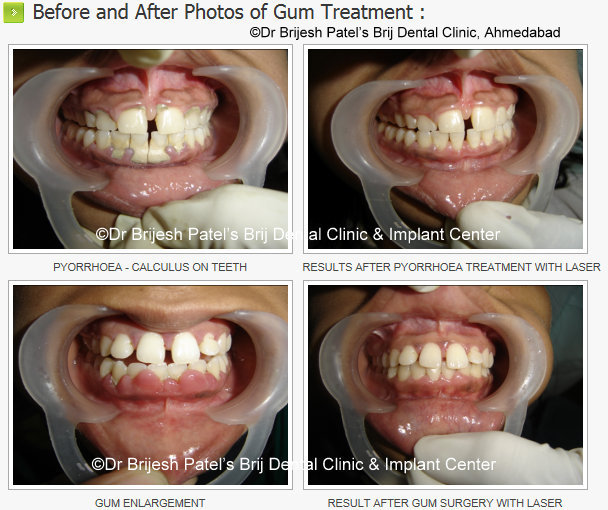 BRIJ DENTAL CLINIC & IMPLANT CENTER Image 6