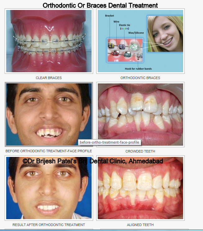 BRIJ DENTAL CLINIC & IMPLANT CENTER Image 9