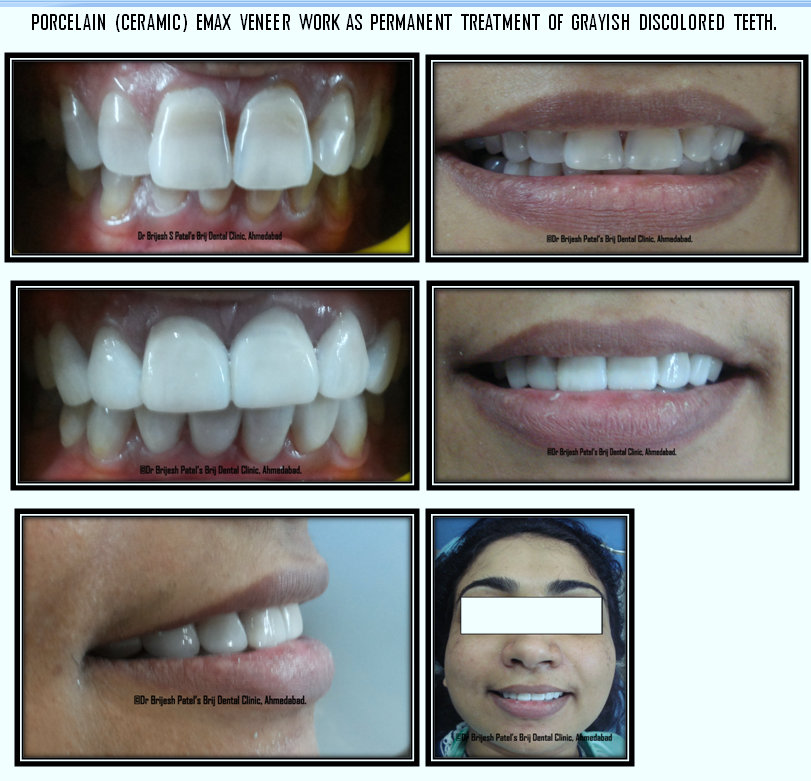 BRIJ DENTAL CLINIC & IMPLANT CENTER Image 7