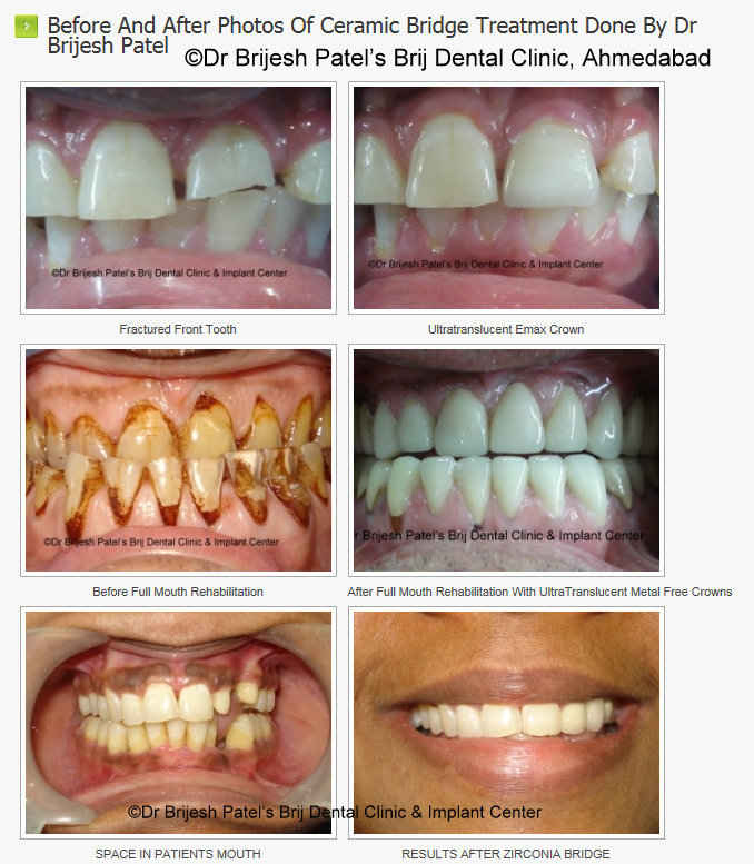 BRIJ DENTAL CLINIC & IMPLANT CENTER Image 3