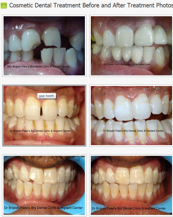 BRIJ DENTAL CLINIC & IMPLANT CENTER Image 5