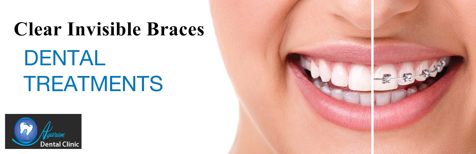 Agaram Dental Clinic Madurai Image 3