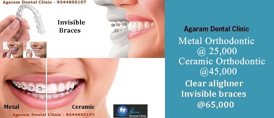 Agaram Dental Clinic Madurai Image 10