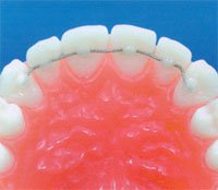 Dr.Pradhan's Smile Solutions Dental Clinic Image 3