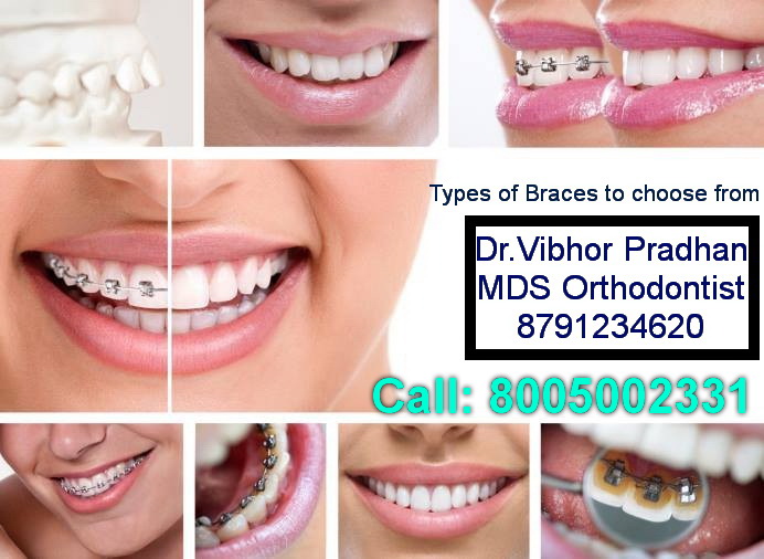 Dr.Pradhan's Smile Solutions Dental Clinic Image 7