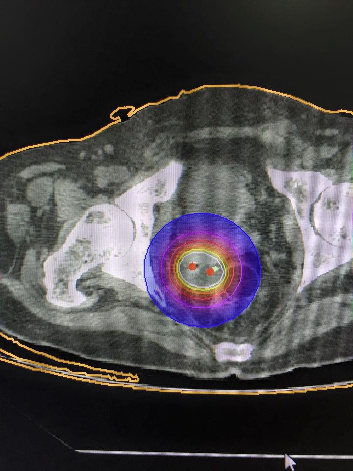 Behgal Cancer Institute Image 3