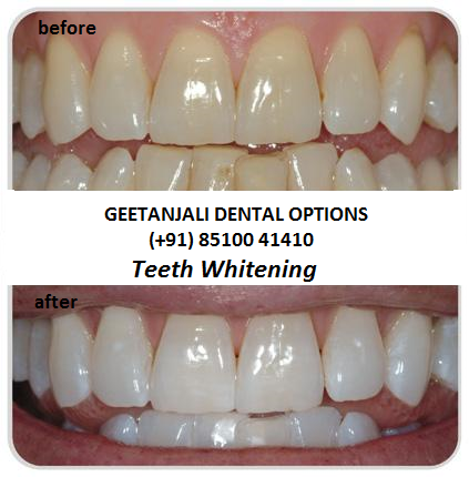 GEETANJALI DENTAL OPTIONS Image 5