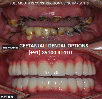 GEETANJALI DENTAL OPTIONS Image 3