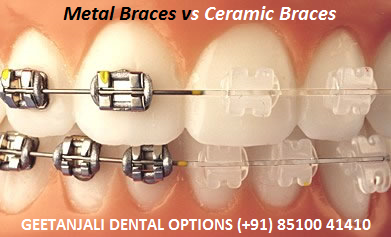 GEETANJALI DENTAL OPTIONS Image 4