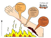 Shri Ram Chand Abrol Memorial Burns Treatment Centre Image 1