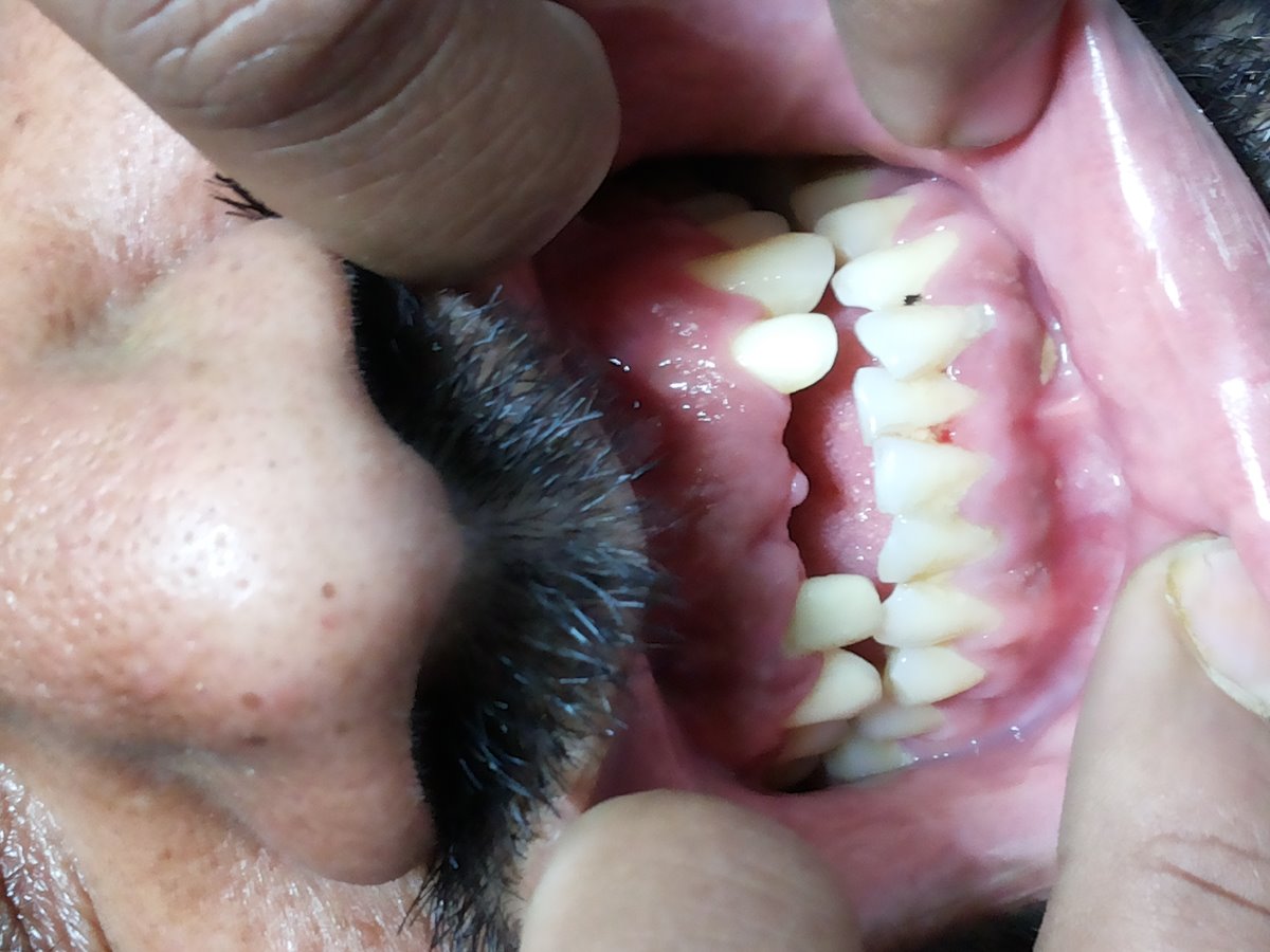 Smile Savers Dental Clinic And Implant Centre Image 2