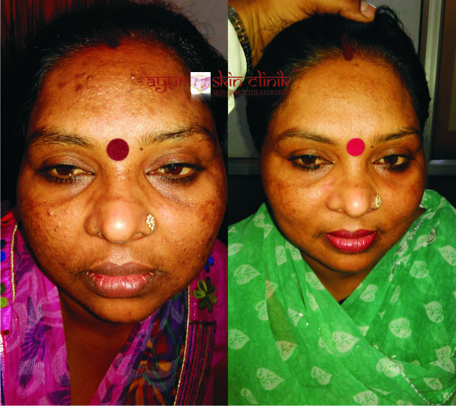 Ayur skin clinic Image 5