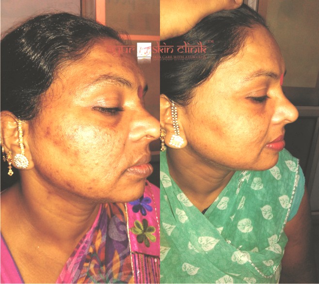 Ayur skin clinic Image 3