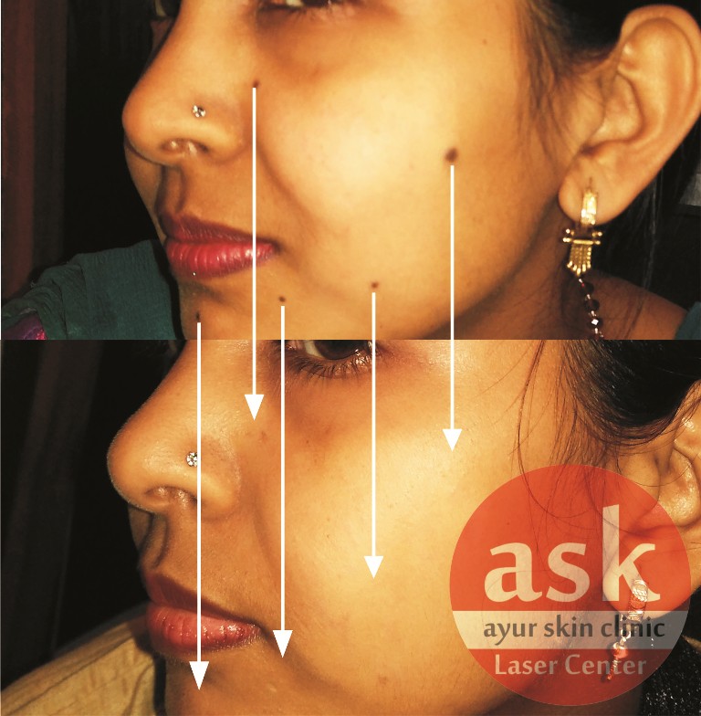 Ayur skin clinic Image 5