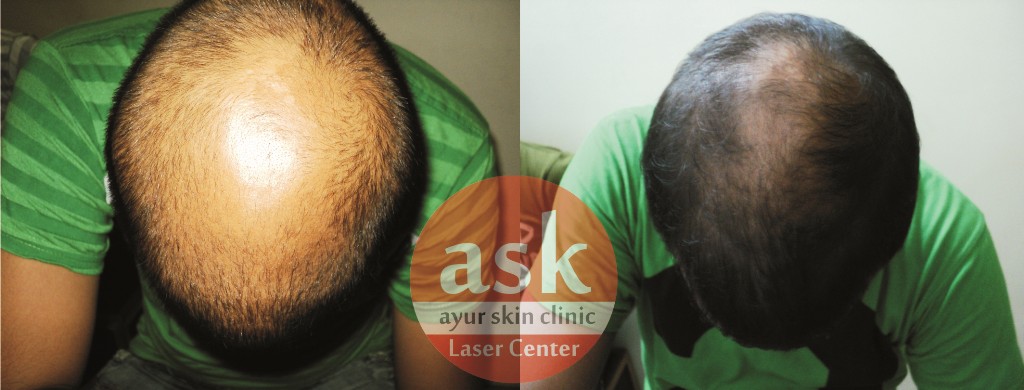 Ayur skin clinic Image 4