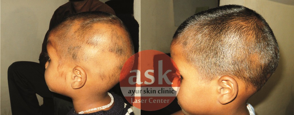 Ayur skin clinic Image 2