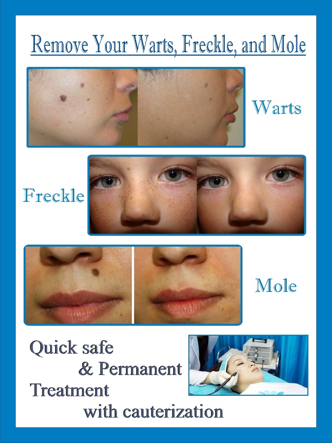 Ayur skin clinic Image 1