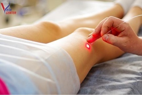 The Vein Center Image 1
