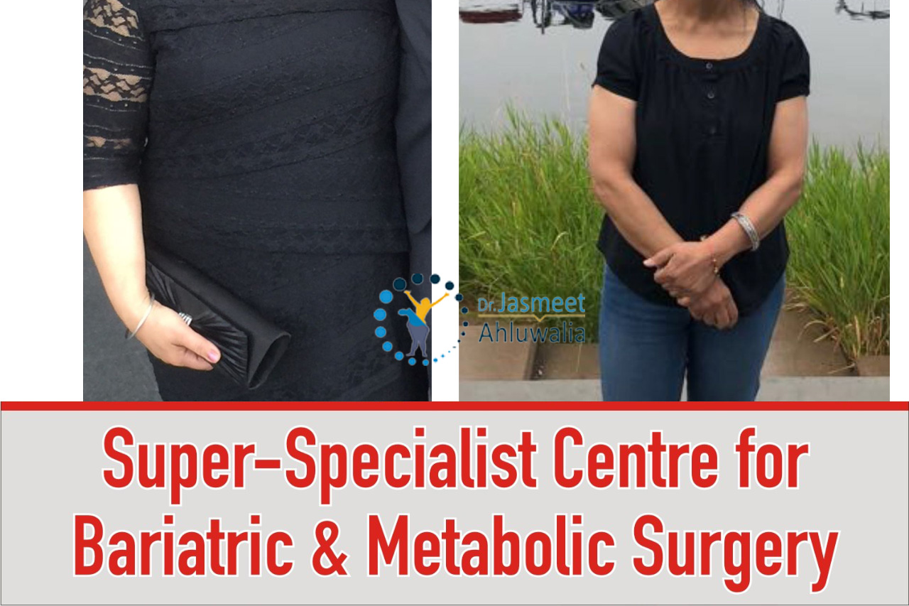STAR Bariatric & Advanced Laparoscopic Surgery Image 8