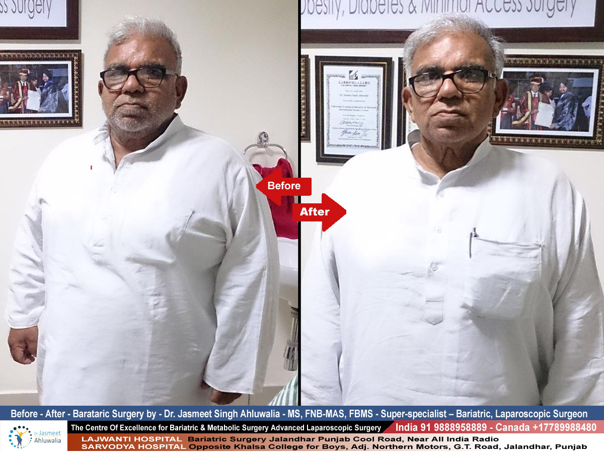 STAR Bariatric & Advanced Laparoscopic Surgery Image 6