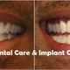 Dr Ratnika's - Smile Up Dental Clinic & Implant Center Image 4