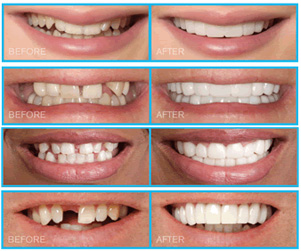 Dr Ratnika's - Smile Up Dental Clinic & Implant Center Image 3