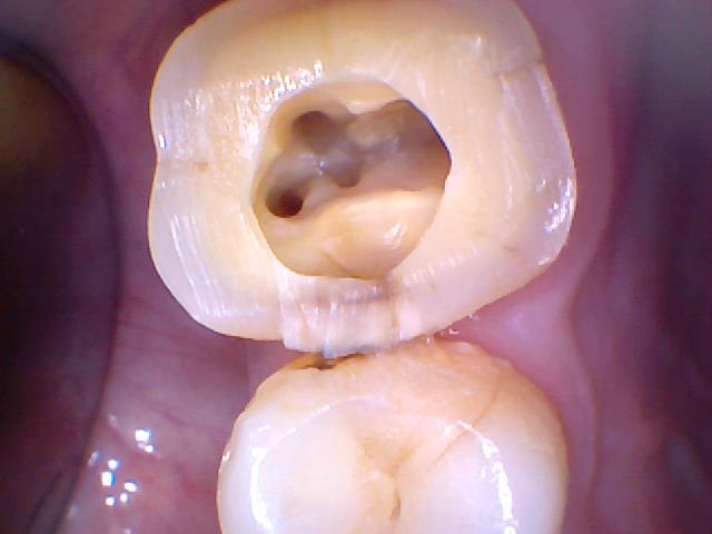 Parth dental clinic Image 4