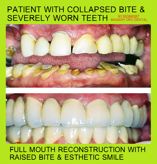 Magadh Oro Dental & Orthodontic Center Image 6